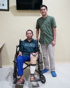 Layanan Prostesis Yang Lengkap, RSU Wajak Husada Pilihan Masyarakat Malang Raya 2